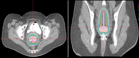 axial image