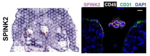 TPCL SPATIAL TRANSCRIPTOMICS