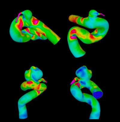 Figure 2 - MRI