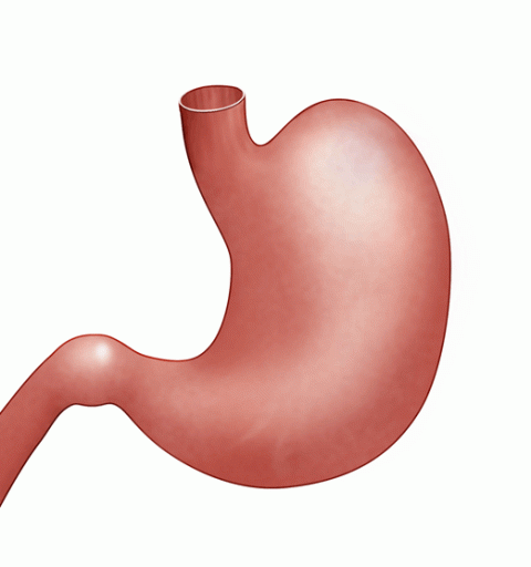 Gastric Sleeve Illustration