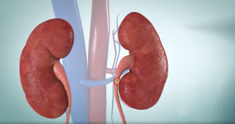 kidney
