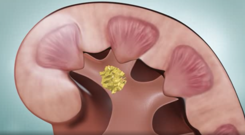 kidney