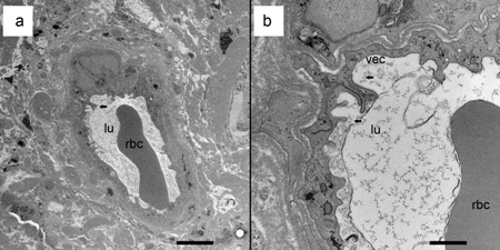 Transmission electron micrograph of a human blood vessel underneath the vestibular sensory epithelia.