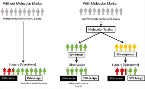 Thyroid Molecular Markers