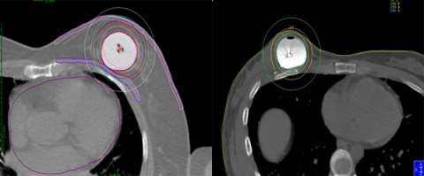 xray