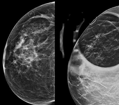 Case: Skin Lesion Figure 1
