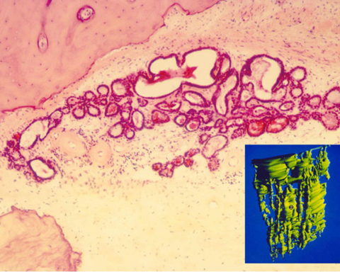 Tubular part of the intraosseous sac with 3D reconstruction.