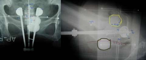CT Scan
