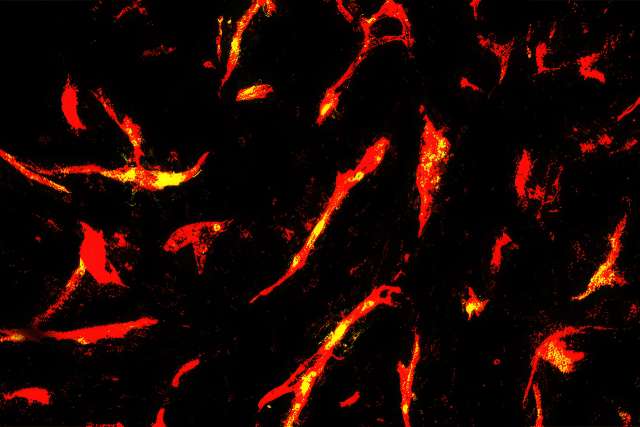 Microscopic view of blood vessels in a mouse glioma tumor.