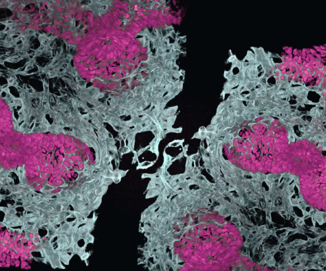 microscopic image of an embryonic mouse lung showing blood vessels (in white) and air sacs (in pink)