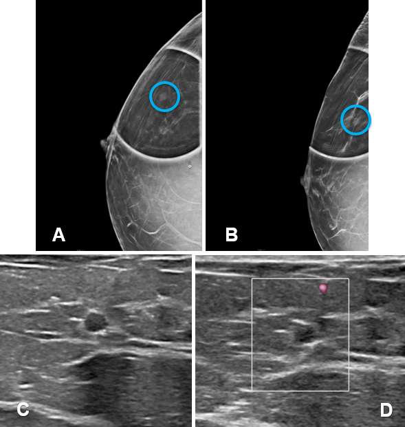 Case: Cysts figure 6