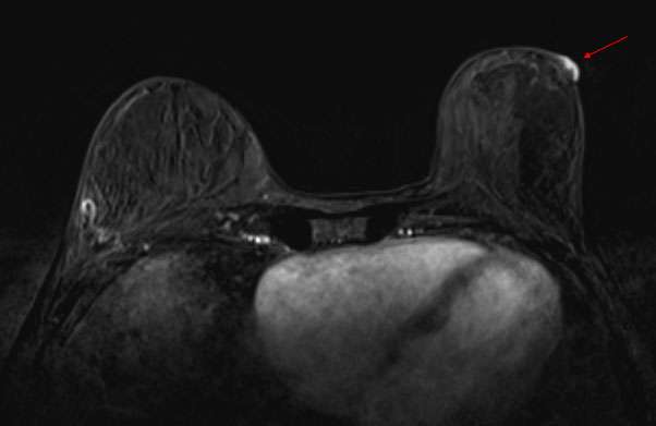 Case: Paget's Disease Figure 3
