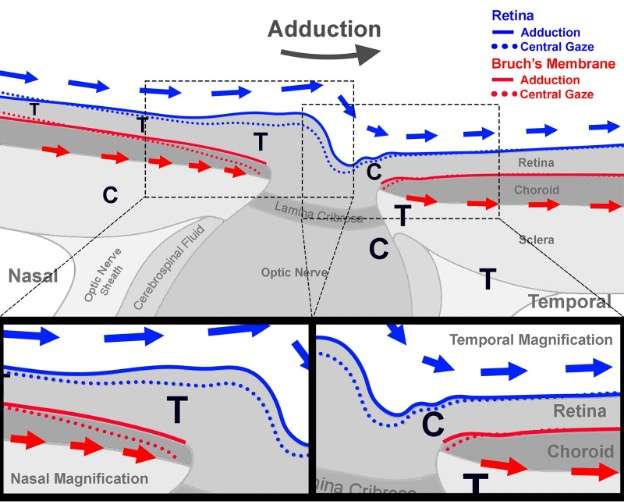 Tethering by the optic nerve diagram