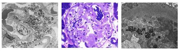 Electron Microscopy Photos - Renal