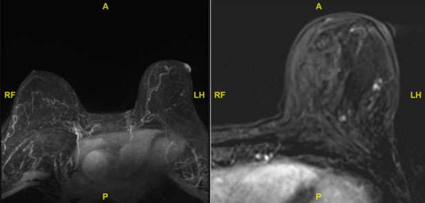 WU: Skin Change Figure 4