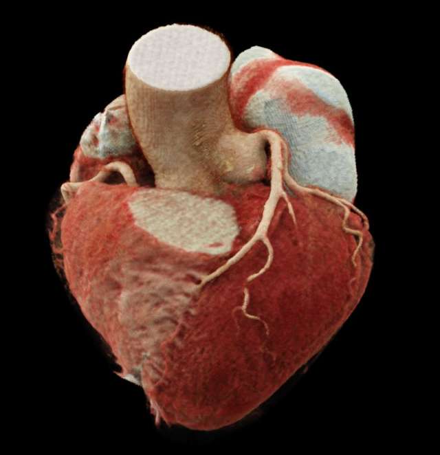 Cinematic Rendering of the Heart