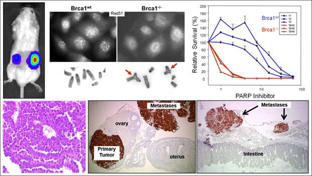 cancer progression diagram