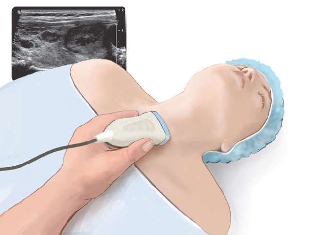 Thyroid Surgery Neck Ultrasound