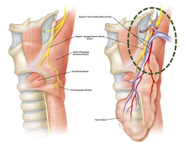 Thyroid Surgery Step 6 Superior Pole