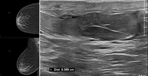 WU: Skin Change Figure 1