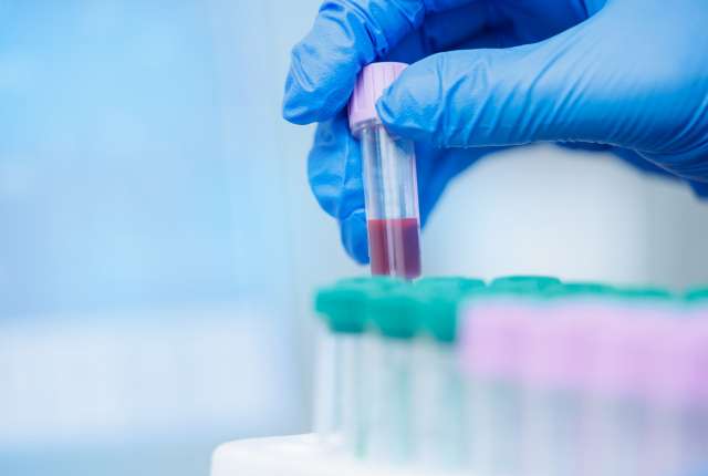 gloved hand holding vial with red liquid above rack of test tubes
