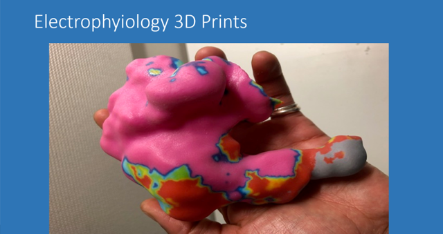 3d heart print