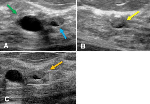 Case: Cysts figure 5