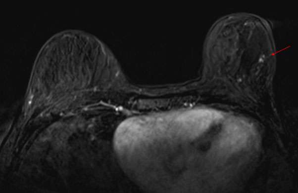 Case: Paget's Disease Figure 4