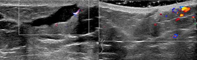 Case: Skin Lesion Figure 2