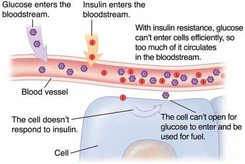 diabetes2