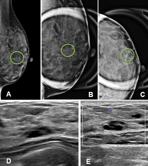 Case: Cysts figure 4