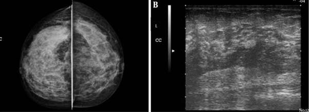 Case: Mastitis Figure 3
