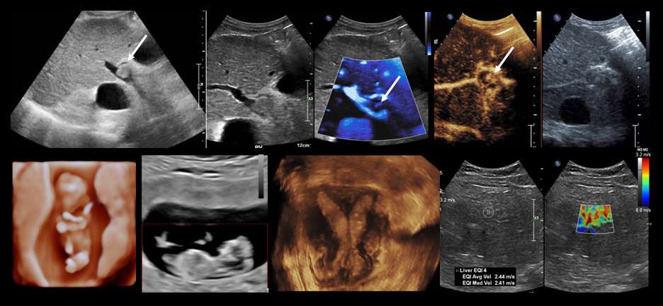 Radiology US Section