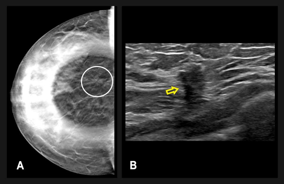 Two medical images: one radiographic, another ultrasound depicting soft tissue.