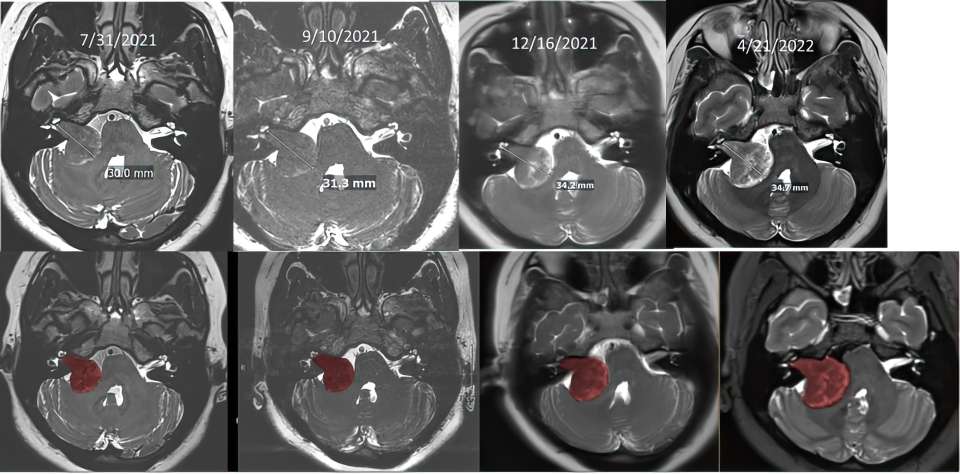 brain scans