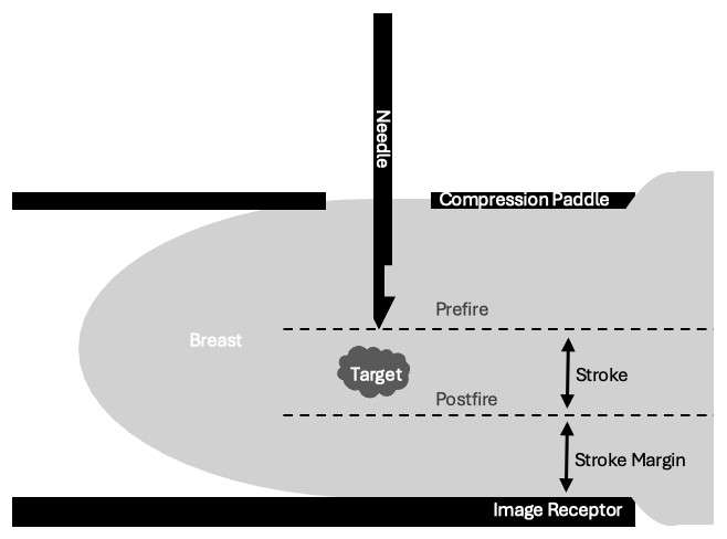 How to perform: Sterotactic (Mammographic guided biopsy) Figure 2