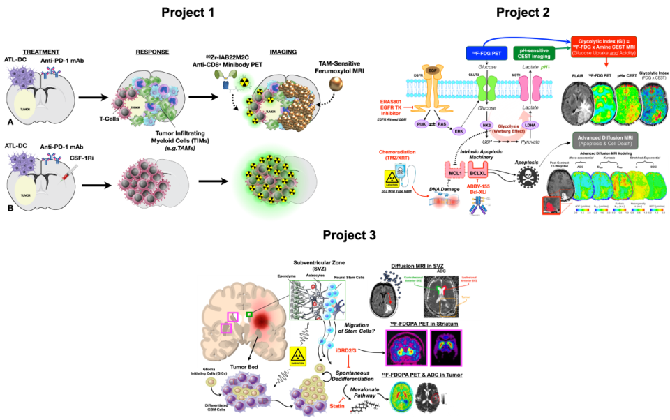 Neuro-Imaging Core showing three brain cancer projects. For Project 1, we theorize that tumors treated with DC vaccination and immune modulation. For Project 2, we theorize that a combined imaging biomarker – simultaneous. For Project 3, we theorize that radiation therapy changes the microstructure of the subventricular zone (SVZ) as measured via diffusion MRI.