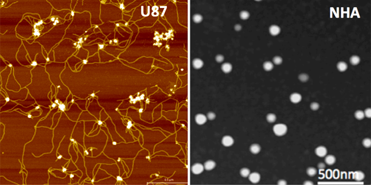 Extracellular vesicles in GBM U87 cells as imaged by atomic force microscopy