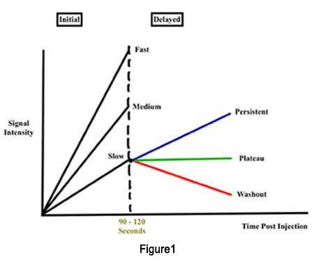 MRI findings