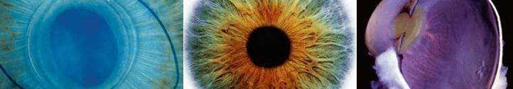 Ophthalmic Pathology