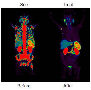 Theranostics see it, treat it