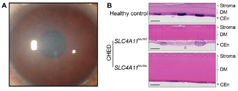 Cornea Research Figure