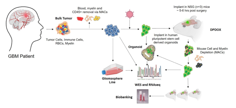 UCLA SPORE in Brain Cancer Core. Showing a GBM Patient, bulk tumor, DPDOX (mouse), organoid, Gliomasphere, WES and RNAseq, Biobanking.