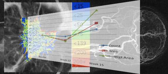 Research program graph