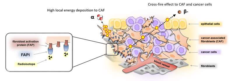 FAP-target for nuclear Theranostics