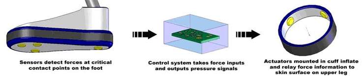 Tactile Feedback for Prostheses and Sensory Neuropathy