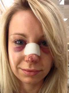 Before surgery