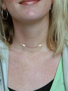 Scar after benign thyroid disease surgery