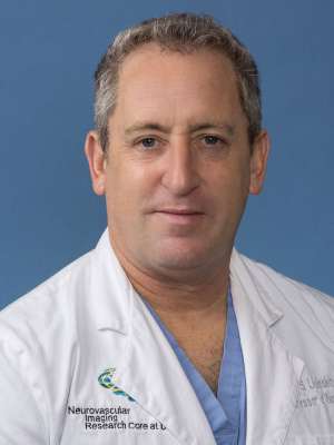 David S. Liebeskind, MD