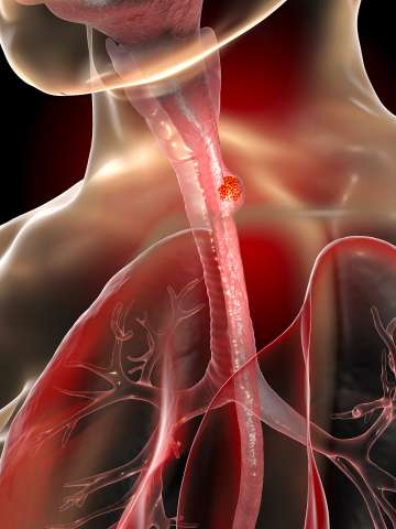 Esophagus illustration